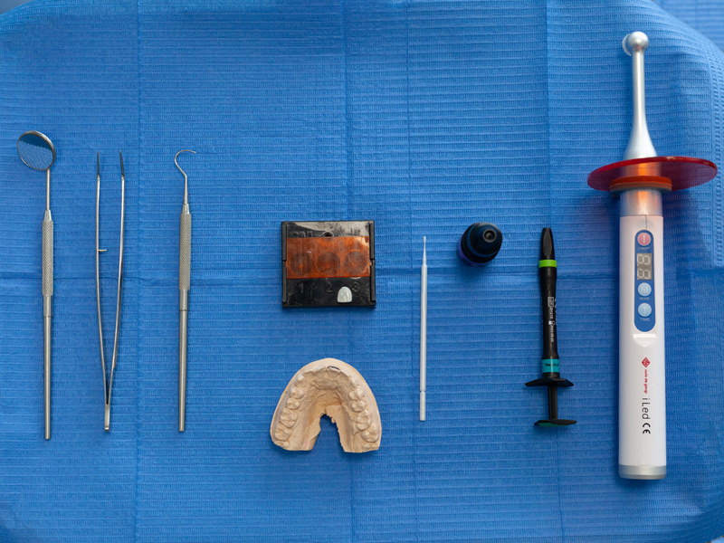 spazio-dental-prestazioni-faccette-estetiche