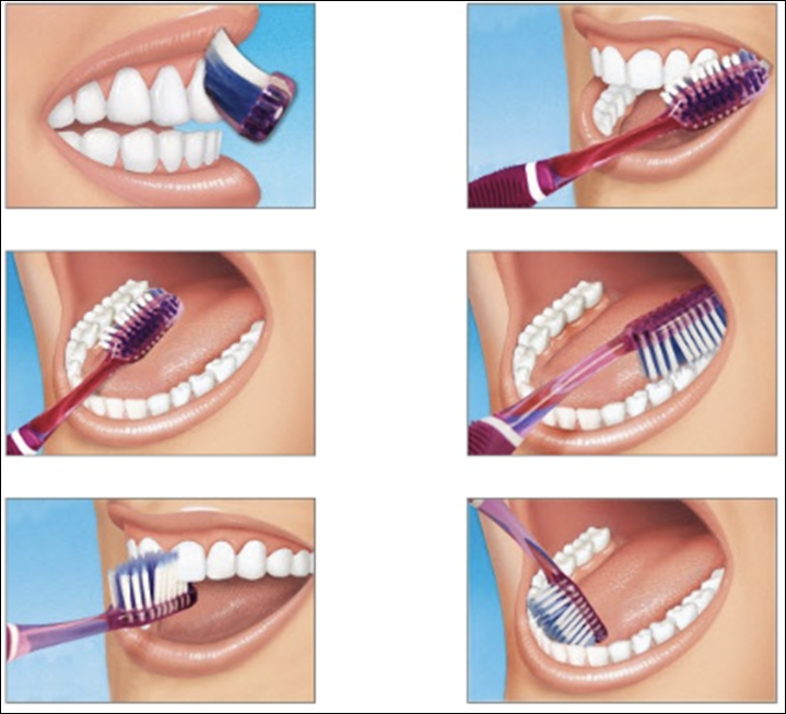 tecnica-di-spazzolamento-dei-denti-spazio-dental-palermo-1 tecnica-di-spazzolamento-dei-denti-spazio-dental-palermo-1