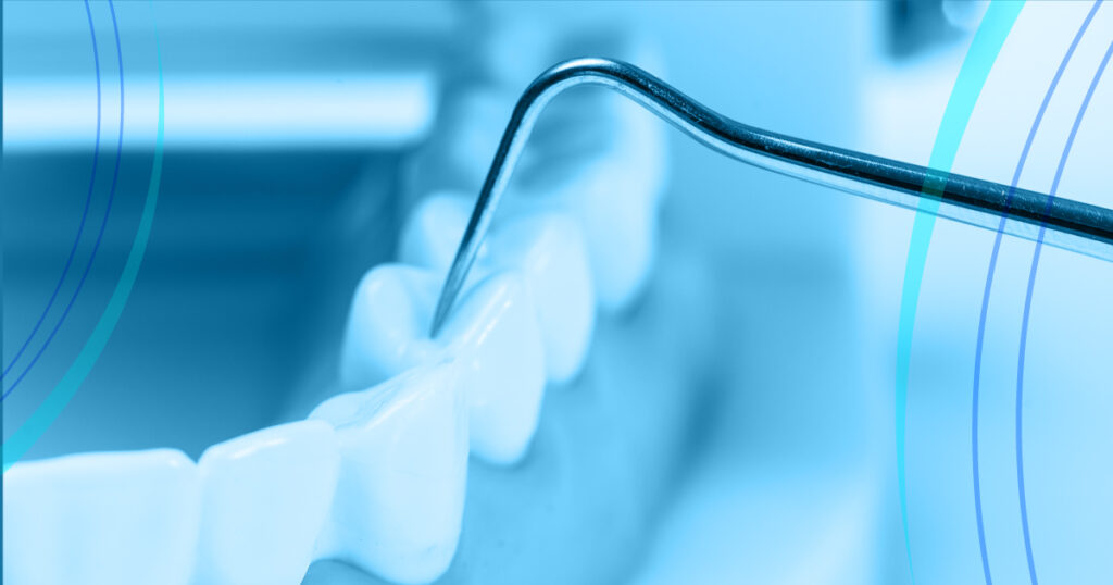 Devitalizzazione-dentaria-quando-occorre-farla