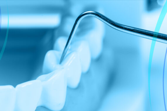 Devitalizzazione-dentaria-quando-occorre-farla