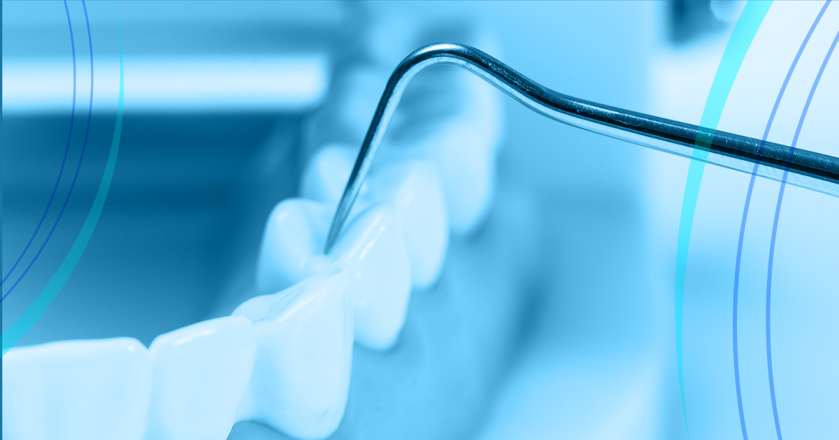 Devitalizzazione-dentaria-quando-occorre-farla