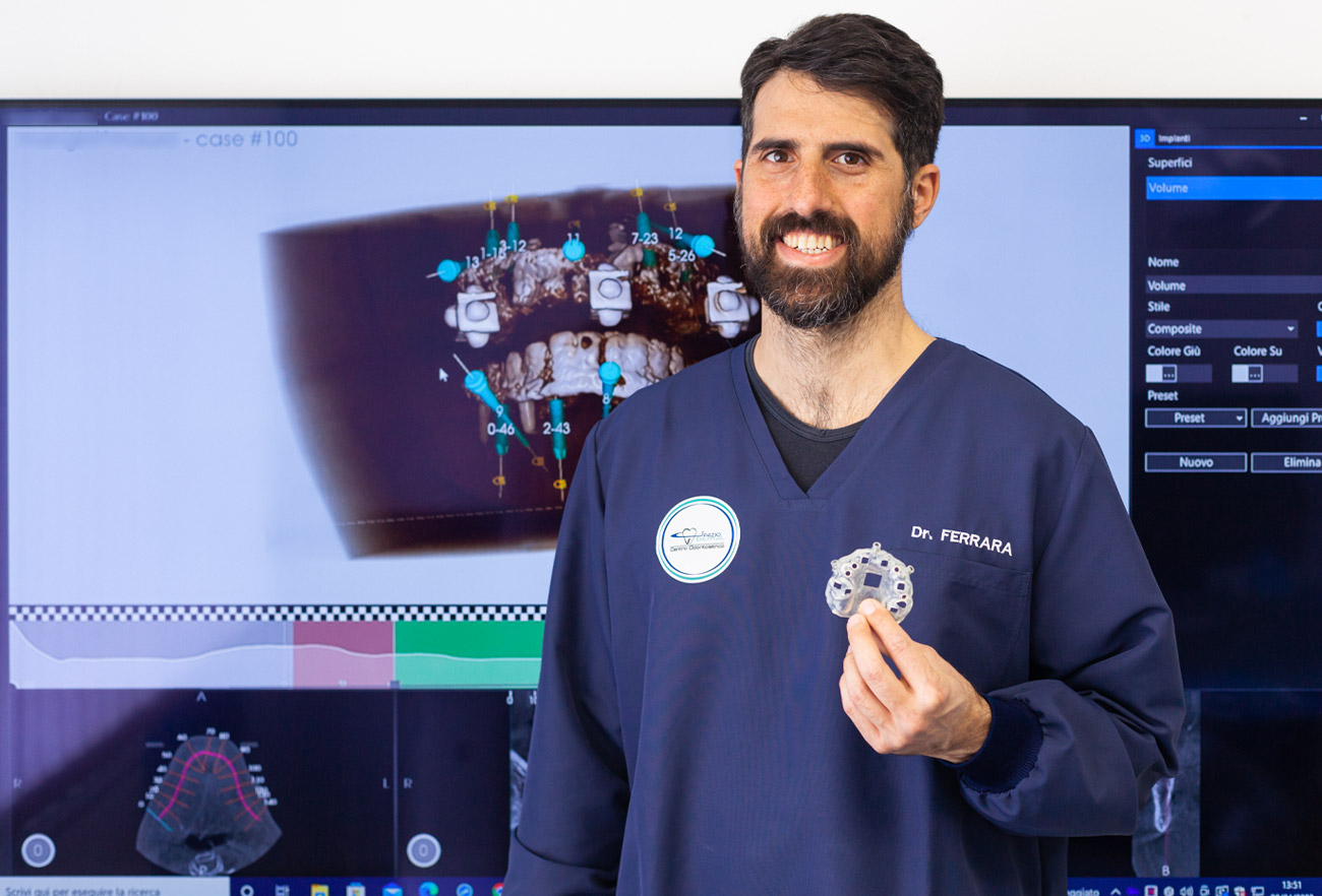 danilo-ferrara-implantologo-implantologia-computer-guidata-spazio-dental danilo-ferrara-implantologo-implantologia-computer-guidata-spazio-dental