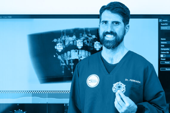 Implantologia-Computer-guidata-fasi-intervento-blog-spazio-dental