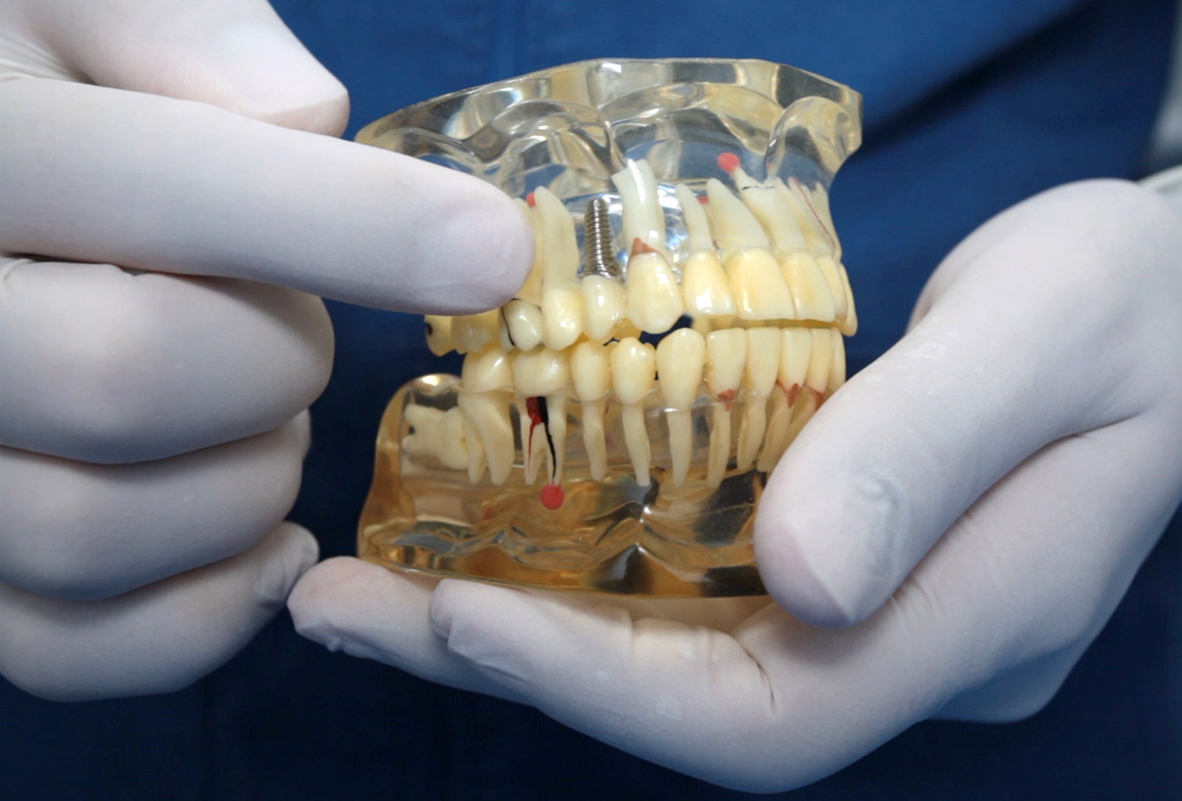 spazio-dental-impianto-dentale poco-osso01