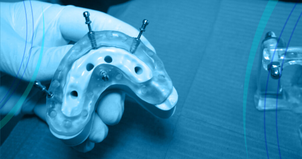 Grazie alla tecnica All on Four è possibile avere una dentatura stabile, grazie ad una protesi fissa posizionata su soli quattro impianti.